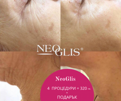 NeoGlis -   
