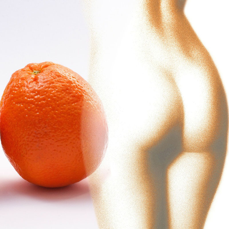 Най-новите технологии, методи,процедури, технологии масажи за бързо премахване и лечение на целулит - портокалова кожа
